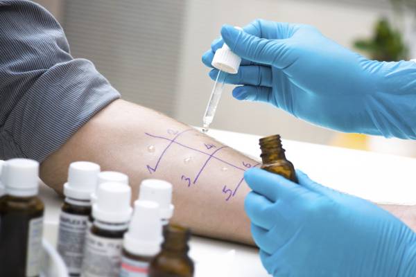 Dermatological Allergy Testing