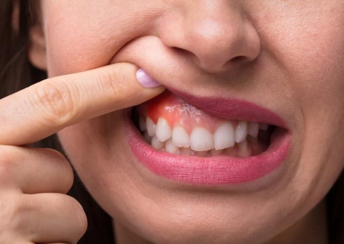 Oral Procedures