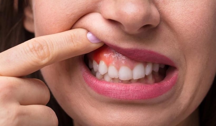 Oral Procedures