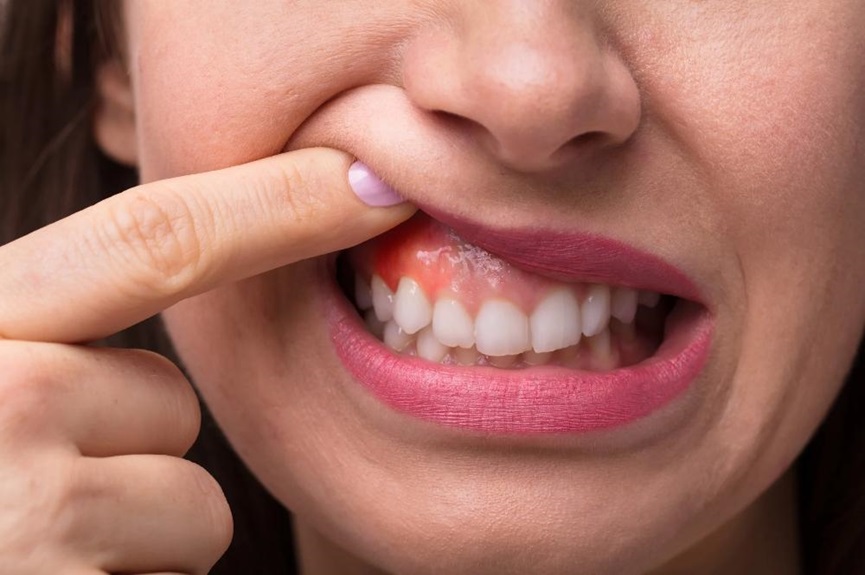 Oral Procedures